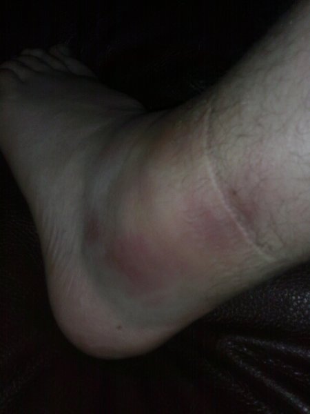 ankle 2.jpg